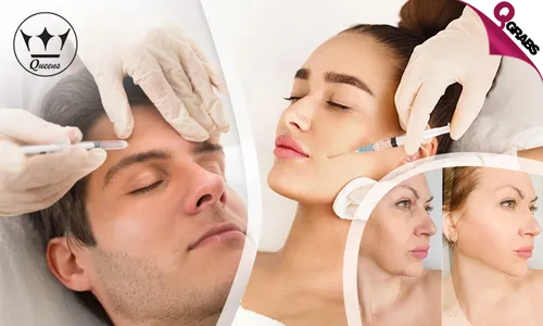 Botox with Consultation for Ladies & Men: Eye & Forehead Wrinkles, V-Shaping & More!
